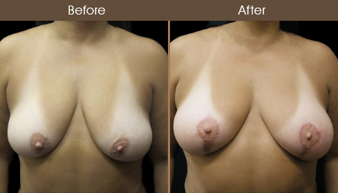 20202805175054_B104-front